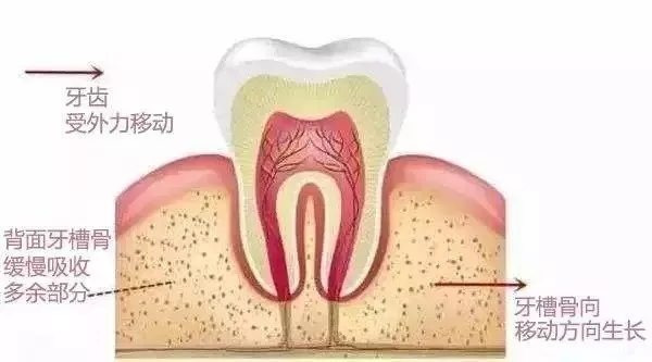 25岁还可以矫正牙齿吗