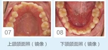 面部口腔拍照