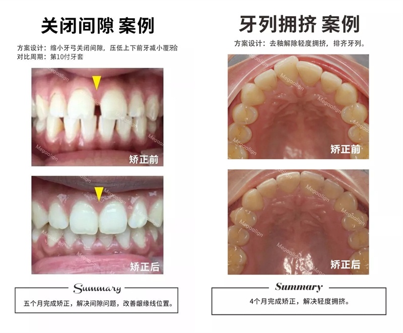 易齐微矫案例