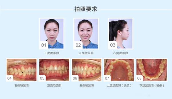 上传的照片参考